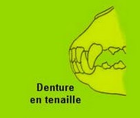Tenaille