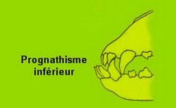 prognathe inferieur